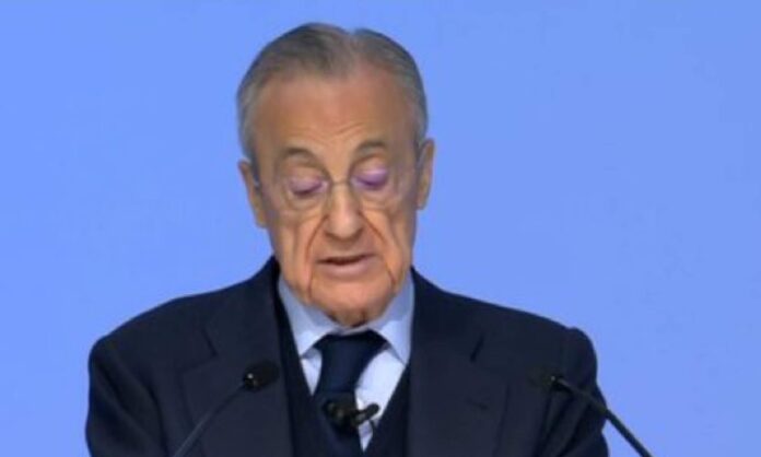 Florentino alza la voz contras las lesiones y la carga de partidos