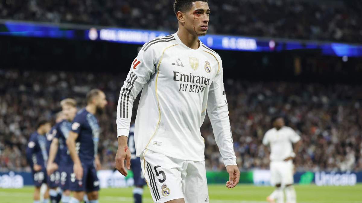 Bellingham, con la ceja rota tras el codazo de Borja Iglesias Bellingham, con la ceja rota tras el codazo de Borja Iglesias